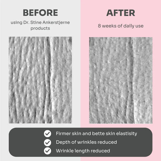 The ANTI-AGE KIT - 4 product giftbox